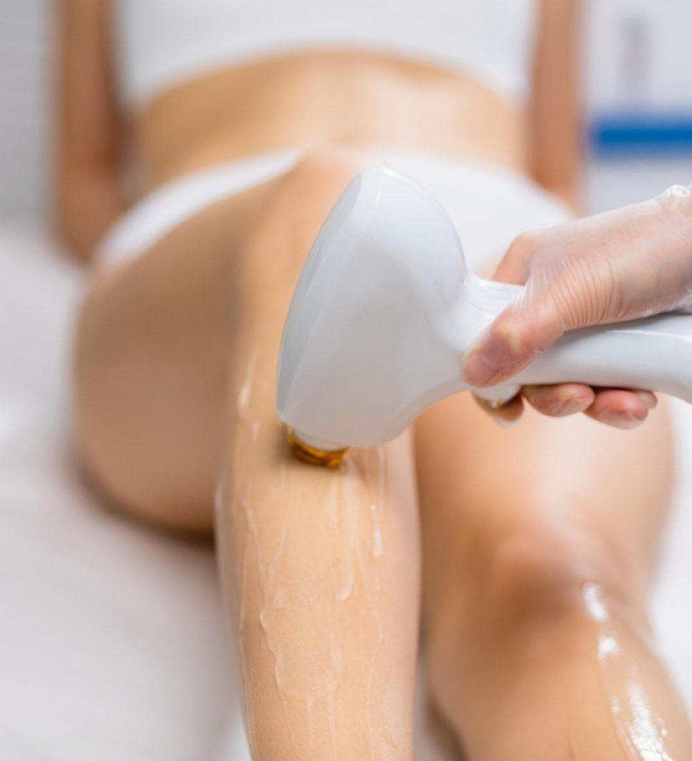 TRATAMENTOS DE FOTODEPILAÇÃO